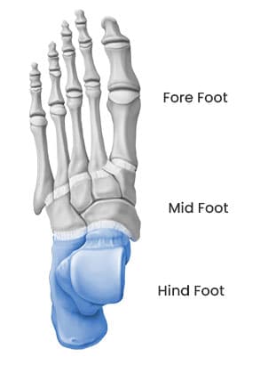 Foot and Ankle Solutions