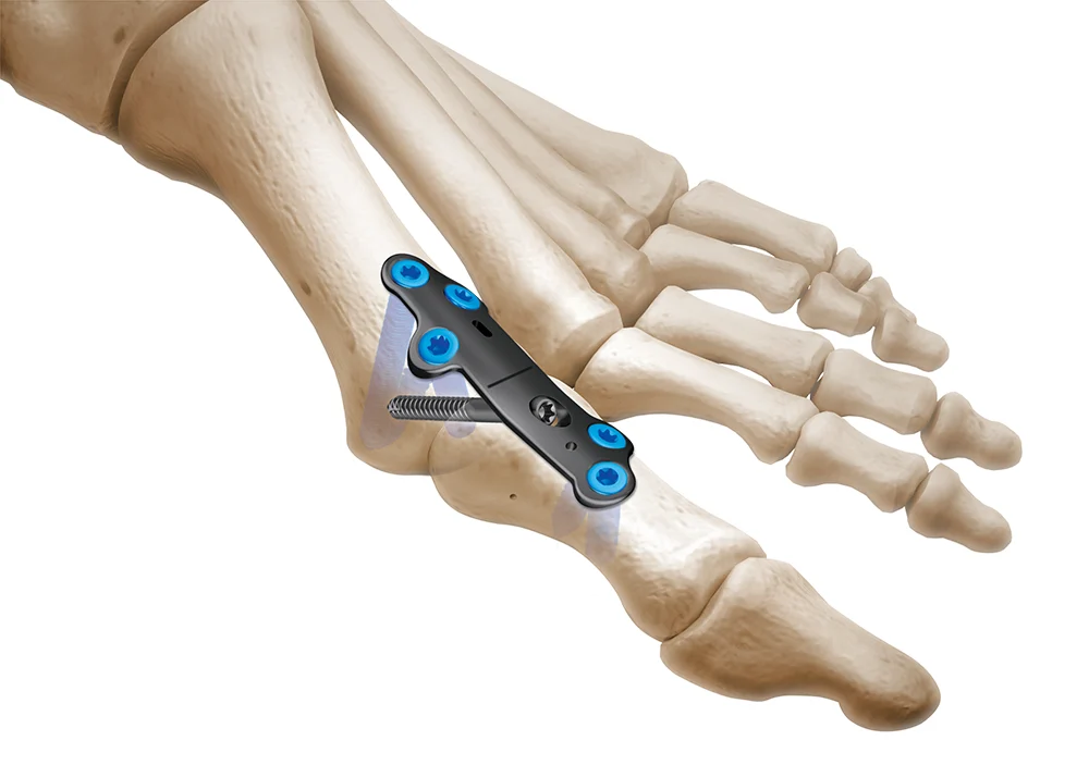 CoLink® XP Plates