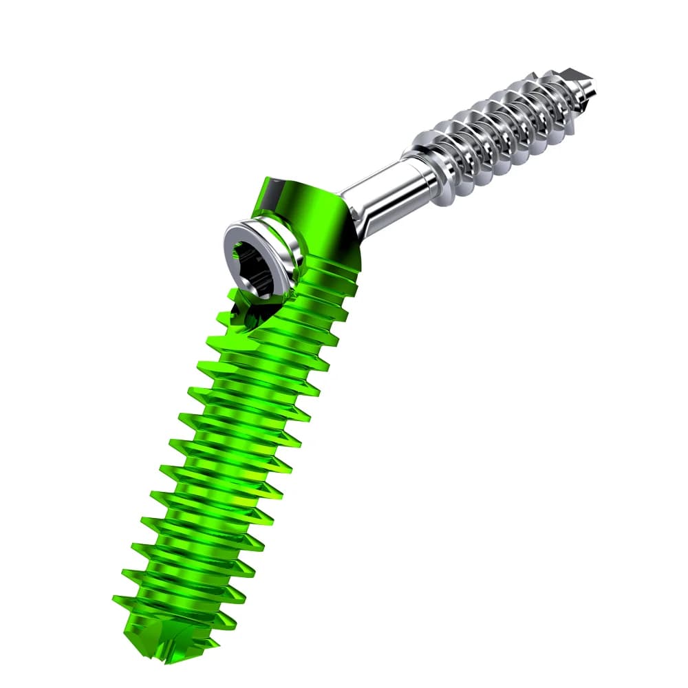ApeX – Interphalangeal Fusion