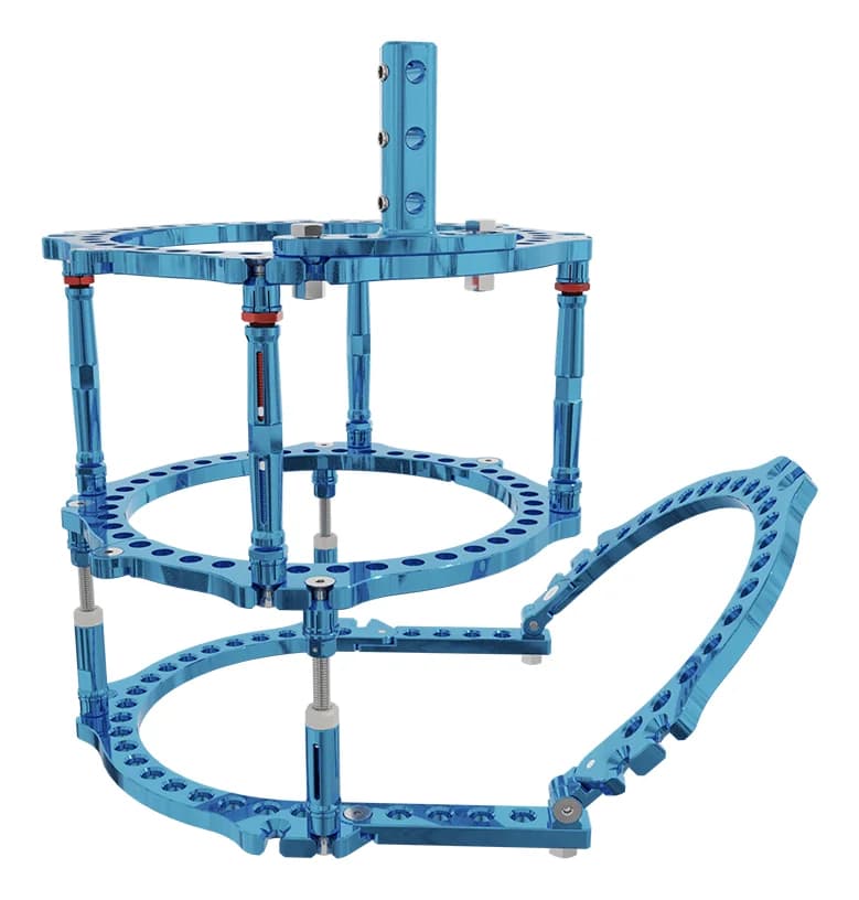 ClickIt CF Circular External Fixator