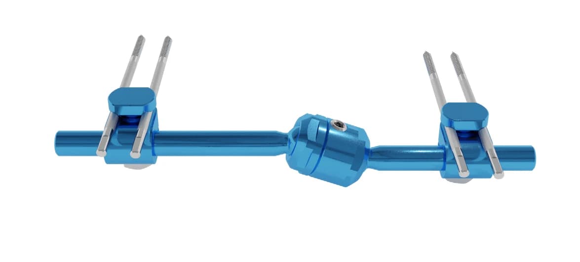 Stylo Diabetic Foot External Fixator