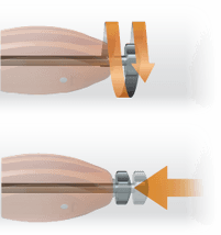 PitStop Subtalar Implant
