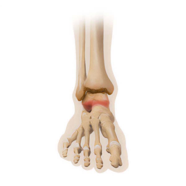 Hindfoot